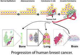 Graphical abstract: Advancement of mass spectrometry-based proteomics technologies to explore triple negative breast cancer