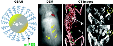 Graphical abstract: Gold silver alloy nanoparticles (GSAN): an imaging probe for breast cancer screening with dual-energy mammography or computed tomography