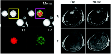 Graphical abstract: Core/shell Fe3O4/Gd2O3 nanocubes as T1–T2 dual modal MRI contrast agents