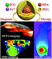 Graphical abstract: Indocyanine green–loaded polydopamine–iron ions coordination nanoparticles for photoacoustic/magnetic resonance dual-modal imaging-guided cancer photothermal therapy