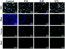 Graphical abstract: Autofluorescence signatures for classifying lung cells during epithelial mesenchymal transition