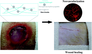 Graphical abstract: Design of a novel wound dressing consisting of alginate hydrogel and simvastatin-incorporated mesoporous hydroxyapatite microspheres for cutaneous wound healing