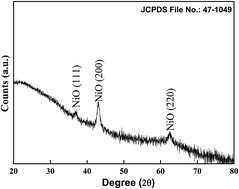 Graphical abstract: Microstructural, electrical and carrier transport properties of Au/NiO/n-GaN heterojunction with a nickel oxide interlayer