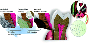 Graphical abstract: Aesthetically improved and efficient tannin–metal chelates for the treatment of dentinal hypersensitivity