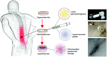 Graphical abstract: Peptide:glycosaminoglycan hybrid hydrogels as an injectable intervention for spinal disc degeneration