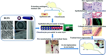 Graphical abstract: Application of a bilayer tubular scaffold based on electrospun poly(l-lactide-co-caprolactone)/collagen fibers and yarns for tracheal tissue engineering