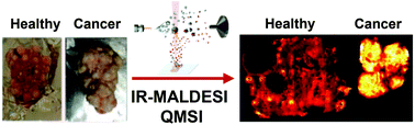 Graphical abstract: Quantitative mass spectrometry imaging of glutathione in healthy and cancerous hen ovarian tissue sections by infrared matrix-assisted laser desorption electrospray ionization (IR-MALDESI)