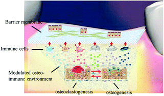 Graphical abstract: The osteoimmunomodulatory property of a barrier collagen membrane and its manipulation via coating nanometer-sized bioactive glass to improve guided bone regeneration