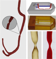 Graphical abstract: Mimicking arterial thrombosis in a 3D-printed microfluidic in vitro vascular model based on computed tomography angiography data