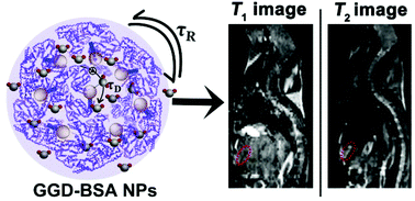 Graphical abstract: Albumin-based nanoparticles loaded with hydrophobic gadolinium chelates as T1–T2 dual-mode contrast agents for accurate liver tumor imaging
