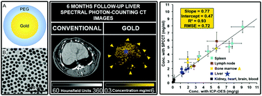 Graphical abstract: Evaluation of spectral photon counting computed tomography K-edge imaging for determination of gold nanoparticle biodistribution in vivo