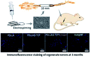 Graphical abstract: Preparation and biocompatibility of electrospinning PDLLA/β-TCP/collagen for peripheral nerve regeneration