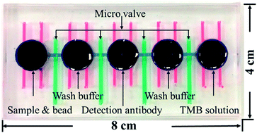 Graphical abstract: Detection of anti-p53 autoantibodies in saliva using microfluidic chips for the rapid screening of oral cancer