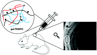 Graphical abstract: Microwave-assisted synthesis of TEMPO-labeled hydrogels traceable with MRI