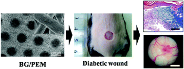 Graphical abstract: A patterned nanocomposite membrane for high-efficiency healing of diabetic wound