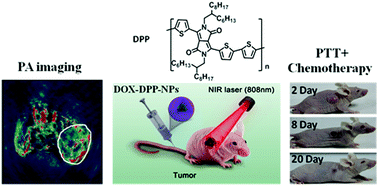 Graphical abstract: Near-infrared conjugated polymers for photoacoustic imaging-guided photothermal/chemo combination therapy