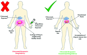 Graphical abstract: Temperature and ultrasound sensitive gatekeepers for the controlled release of chemotherapeutic drugs from mesoporous silica nanoparticles