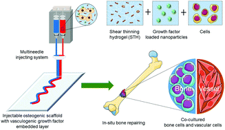 Graphical abstract: Injectable shear-thinning hydrogels for delivering osteogenic and angiogenic cells and growth factors