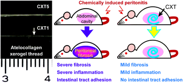 Graphical abstract: A high-density collagen xerogel thread prevents the progression of peritoneal fibrosis