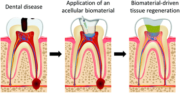 Graphical abstract: Acellular biomaterial strategies for endodontic regeneration