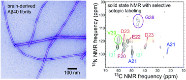 Graphical abstract: Coexisting order and disorder within a common 40-residue amyloid-β fibril structure in Alzheimer's disease brain tissue