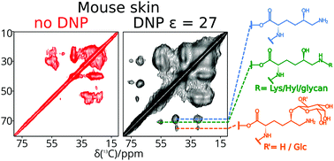 Graphical abstract: Essential but sparse collagen hydroxylysyl post-translational modifications detected by DNP NMR