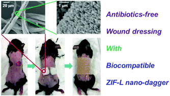 Graphical abstract: ZIF nano-dagger coated gauze for antibiotic-free wound dressing