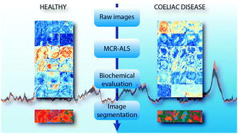 Graphical abstract: Potential use of MCR-ALS for the identification of coeliac-related biochemical changes in hyperspectral Raman maps from pediatric intestinal biopsies