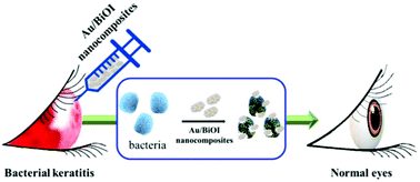 Graphical abstract: Green synthesis of catalytic gold/bismuth oxyiodide nanocomposites with oxygen vacancies for treatment of bacterial infections