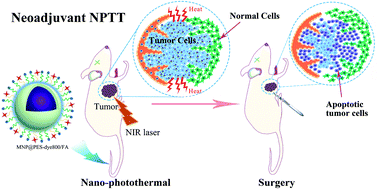 Graphical abstract: Neoadjuvant nano-photothermal therapy used before operation effectively assists in surgery for breast cancer