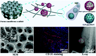 Graphical abstract: Porous nanofibrous scaffold incorporated with S1P loaded mesoporous silica nanoparticles and BMP-2 encapsulated PLGA microspheres for enhancing angiogenesis and osteogenesis