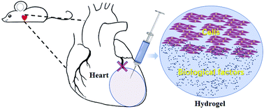 Graphical abstract: Retracted Article: Development of functional hydrogels for heart failure