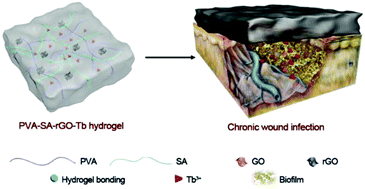 Graphical abstract: A synergistic antibacterial effect between terbium ions and reduced graphene oxide in a poly(vinyl alcohol)–alginate hydrogel for treating infected chronic wounds