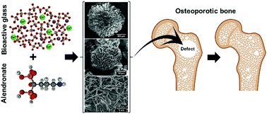 Graphical abstract: Hybrid particles derived from alendronate and bioactive glass for treatment of osteoporotic bone defects