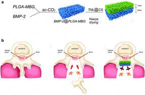 Graphical abstract: A tranilast and BMP-2 based functional bilayer membrane is effective for the prevention of epidural fibrosis during spinal lamina reconstruction