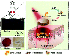 Graphical abstract: Copper-nanoparticle-embedded hydrogel for killing bacteria and promoting wound healing with photothermal therapy