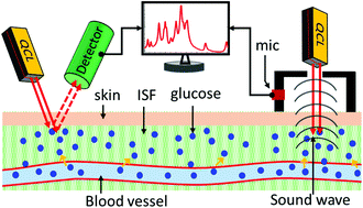 Graphical abstract: Noninvasive blood glucose detection using a quantum cascade laser