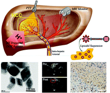 Graphical abstract: Designing pH-triggered drug release iron oxide nanocomposites for MRI-guided photothermal-chemoembolization therapy of liver orthotopic cancer