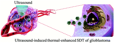 Graphical abstract: Imaging-guided focused ultrasound-induced thermal and sonodynamic effects of nanosonosensitizers for synergistic enhancement of glioblastoma therapy