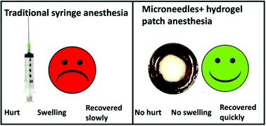 Graphical abstract: Microneedles combined with a sticky and heatable hydrogel for local painless anesthesia