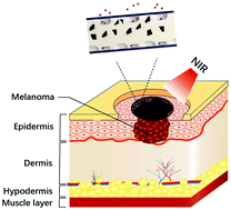 Graphical abstract: A controllable local drug delivery system based on porous fibers for synergistic treatment of melanoma and promoting wound healing