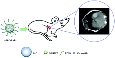 Graphical abstract: Gadolinium-loaded calcium phosphate nanoparticles for magnetic resonance imaging of orthotopic hepatocarcinoma and primary hepatocellular carcinoma