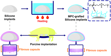 Graphical abstract: Efficient reduction of fibrous capsule formation around silicone breast implants densely grafted with 2-methacryloyloxyethyl phosphorylcholine (MPC) polymers by heat-induced polymerization