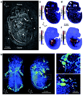Graphical abstract: Construction of 3D native elemental maps for large biological specimens using LA-ICP-MS coupled with X-ray tomography