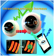 Graphical abstract: Photonic crystal-based smart contact lens for continuous intraocular pressure monitoring