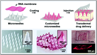 Graphical abstract: Universally applicable RNA membrane-based microneedle system for transdermal drug delivery