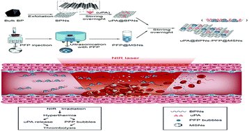 Graphical abstract: A champagne inspired dual chain-responsive thrombolytic drug release platform based on black phosphorus nanosheets for accelerated thrombolysis