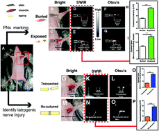 Graphical abstract: Shortwave infrared fluorescence in vivo imaging of nerves for minimizing the risk of intraoperative nerve injury