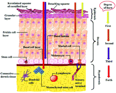 Graphical abstract: Wound dressings functionalized with silver nanoparticles: promises and pitfalls