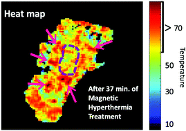 Graphical abstract: Mapping intracellular thermal response of cancer cells to magnetic hyperthermia treatment